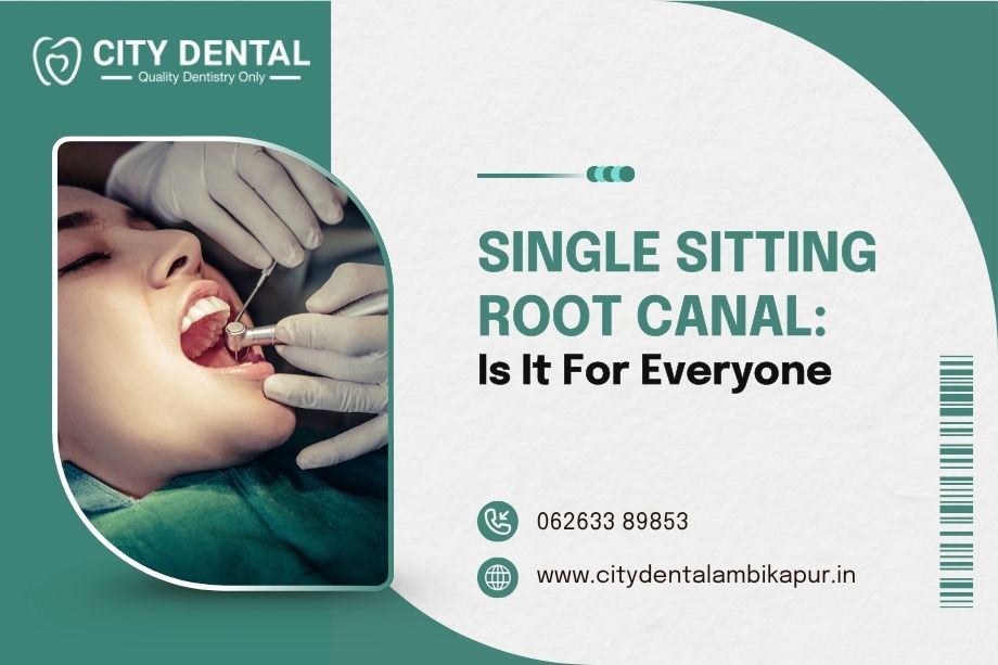 Single Sitting Root Canal Is It For Everyone