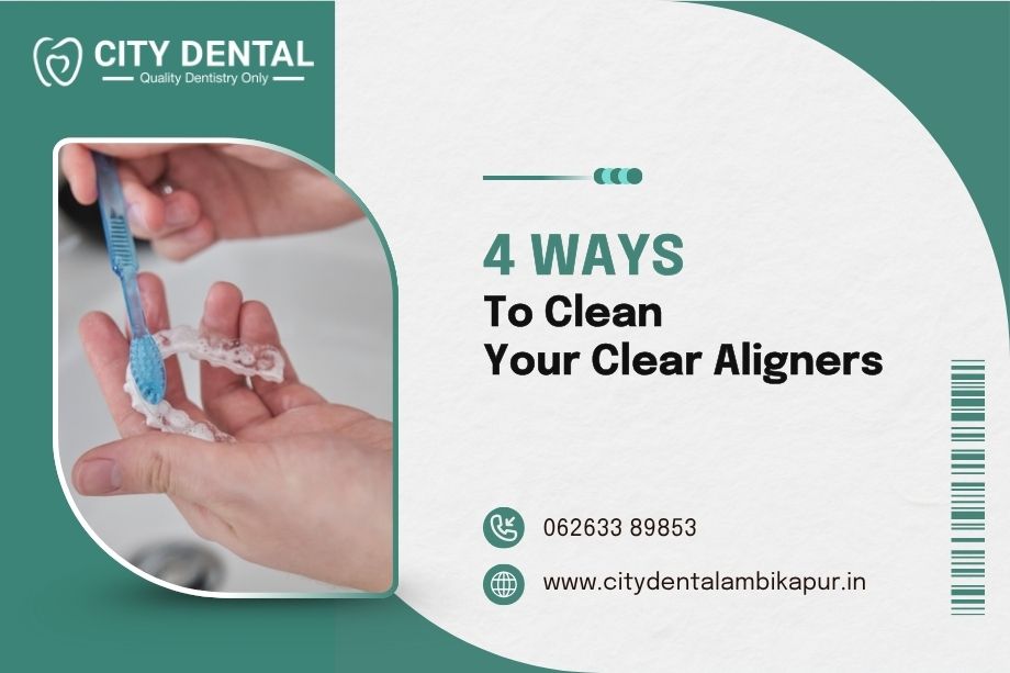 4 ways to clean your clear aligners