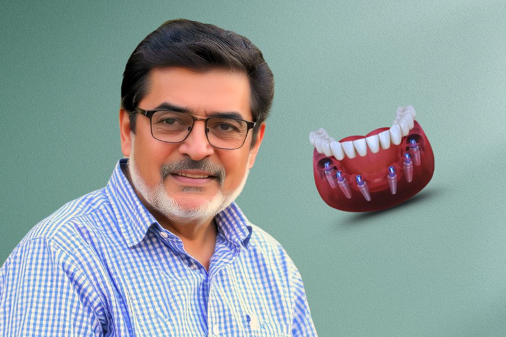 All-On-6-Dental-Implants