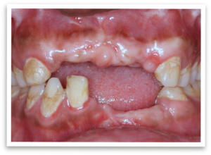 A Path With Challenges