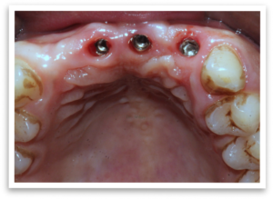 Resolve To Find Solution