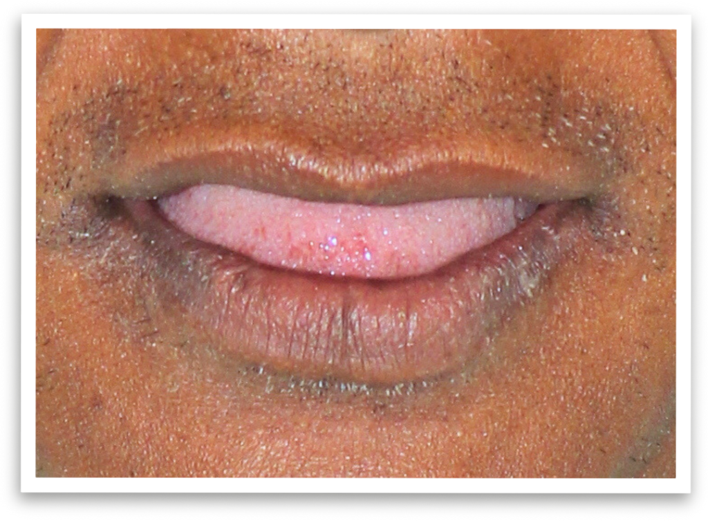 A-persons-smile-is-the-gateway