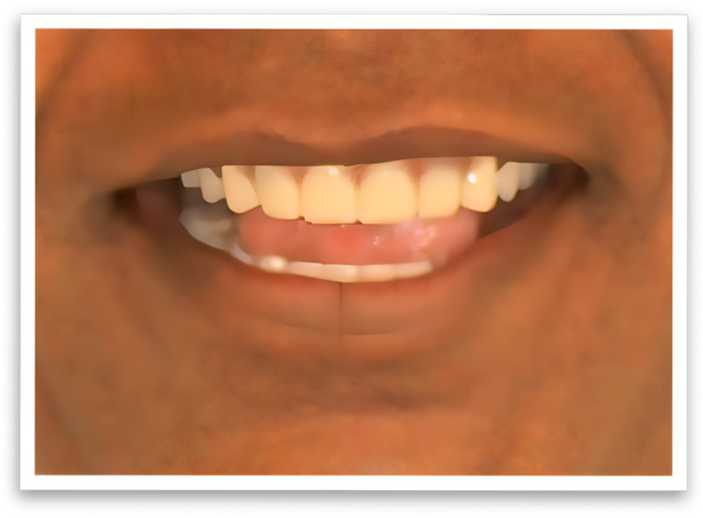 teeth image