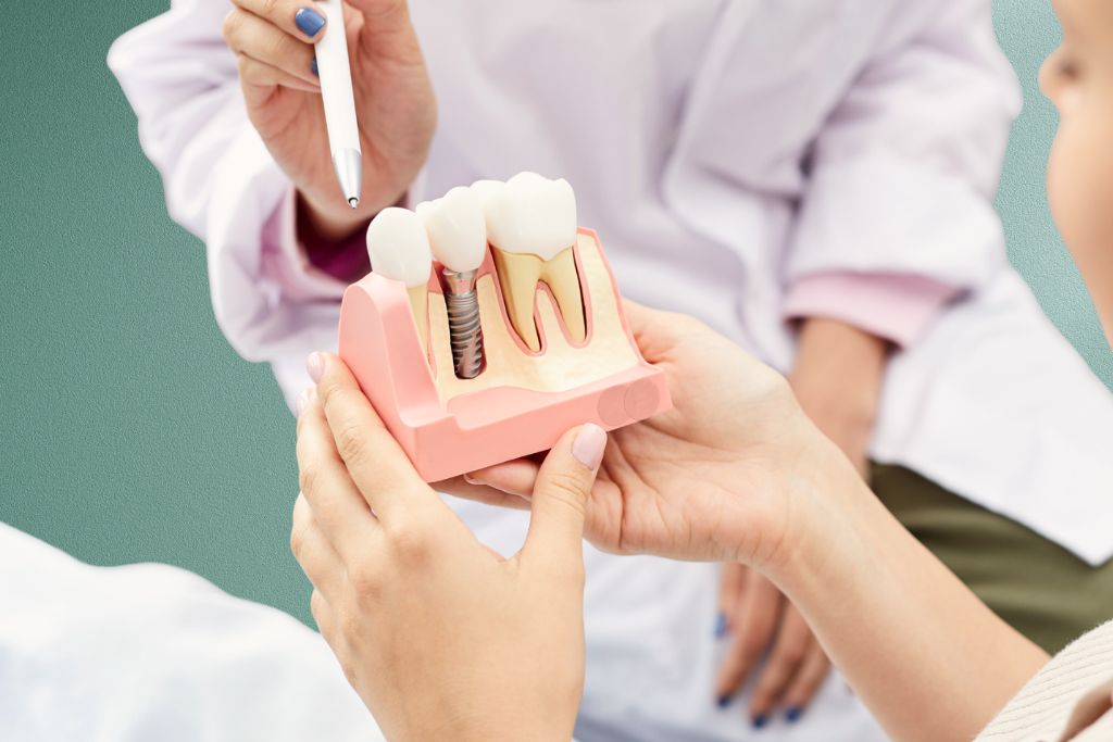 Dental-Implant-Treatment