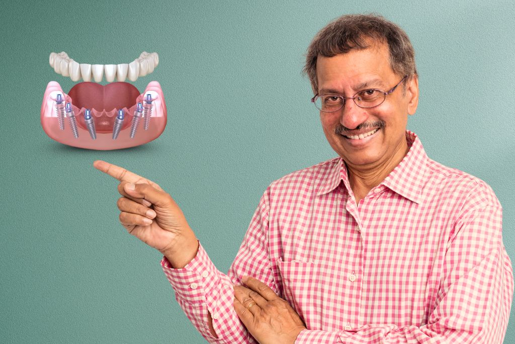 Full Mouth Rehabilitation