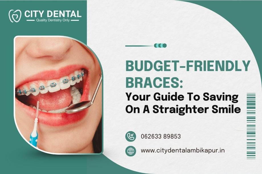 budgetfriendly-braces-your-guide-to-saving-on-a-straighter-smile
