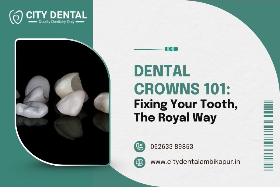 dental-crowns-101-fixing-your-tooth-the-royal-way