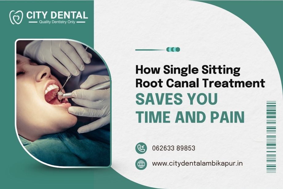 how-single-sitting-root-canal-treatment-saves-you-time-and-pain