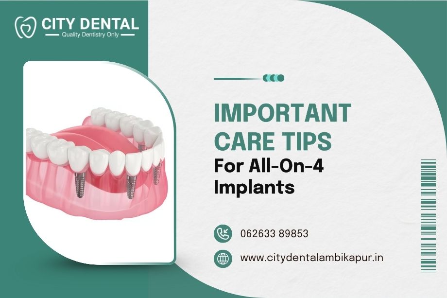 important care tips for allon4-implants