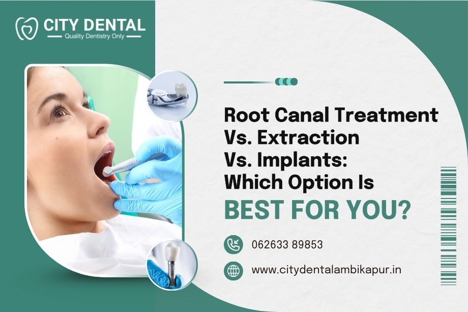 root-canal-treatment-vs-extraction-vs-implants-which-option-is-best-for-you