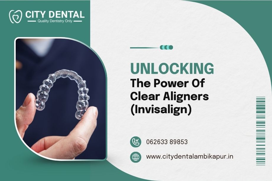 unlocking-the-power-of-clear-aligners-invisalign